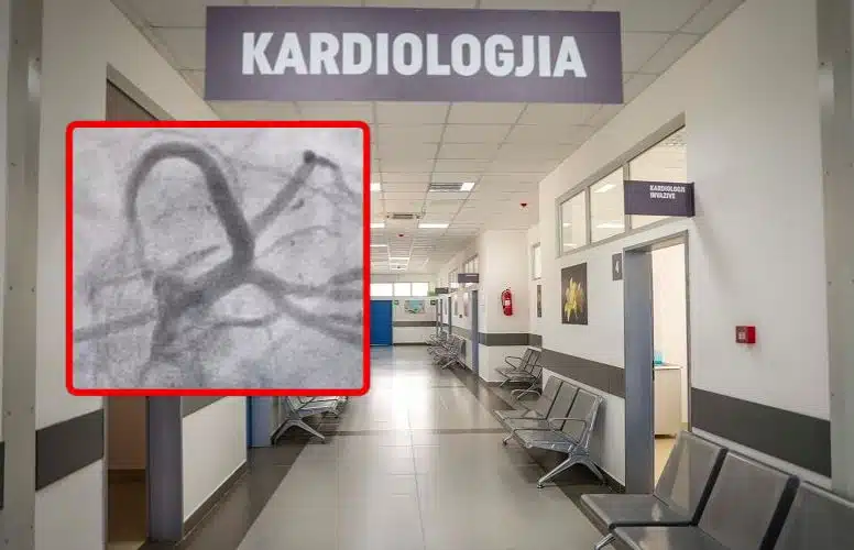 Infarkti akut po prek moshat e reja: 37-vjeçarit i vendoset stenta në Kardiologjinë Invazive në QKUK
