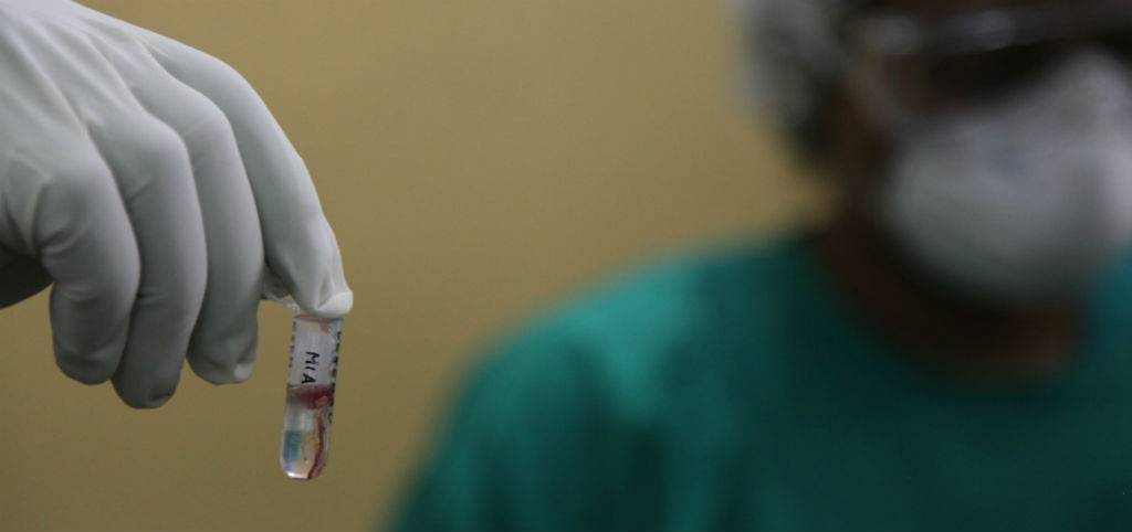 Përfundon autopsia e 35 vjeçares – i janë gjetur tre plumba, një në kokë dhe dy në gjoks