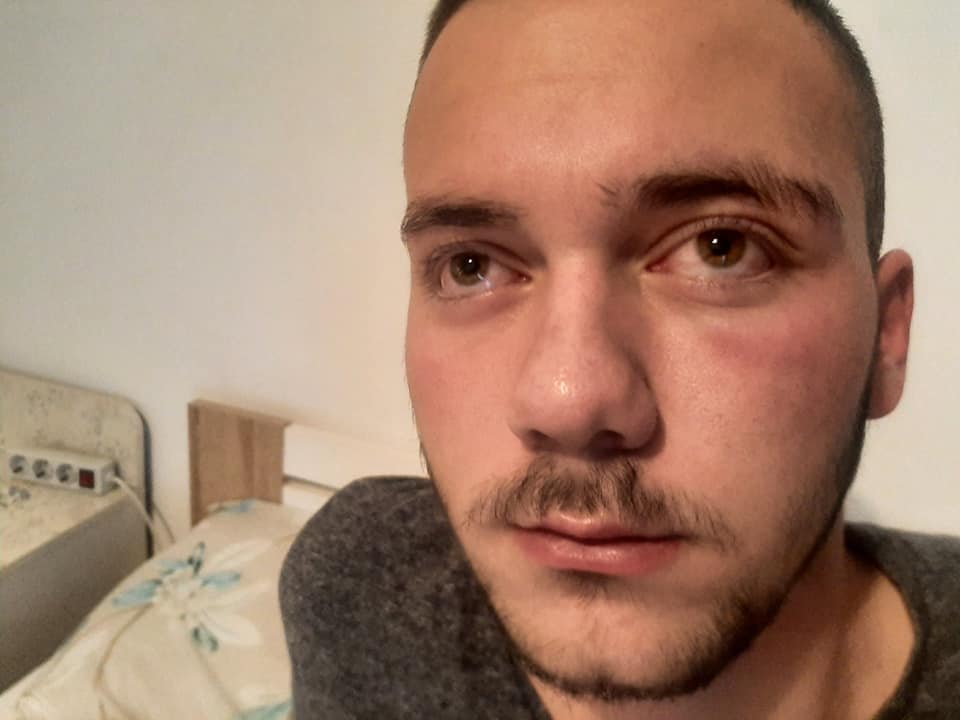 Rrahja e raportuar në Kllokot, Policia e konfirmon rastin: Ankuesit ishin të dehur