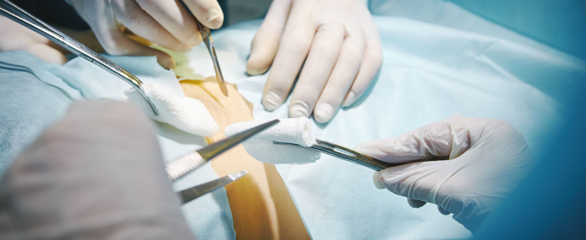 Kirurgjia Abdominale pa pajisje për operim, Fekaj: S’kemi zgjidhje tjetër, ose të ndërpriten intervenimet ose materiali të sigurohet nga pacientet!