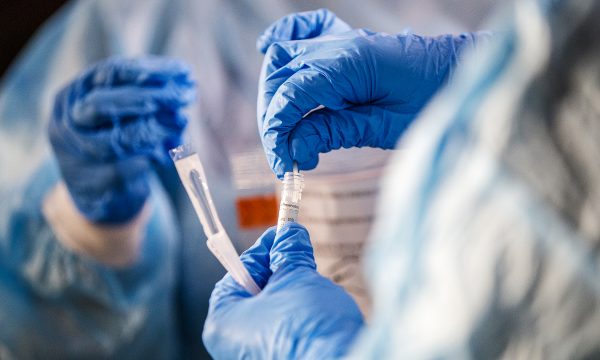 21 raste të reja me Covid-19