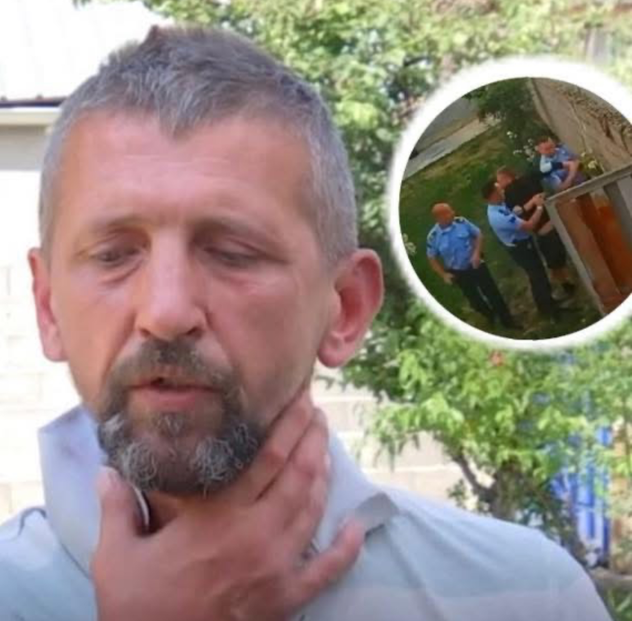 “Ma kanë ngjit për fyti”, flet burri që u sulmua nga policët në Klinë