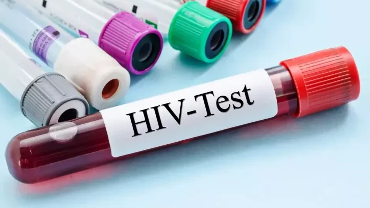 Dhjetë raste të reja me HIV në muajt e fundit, dy viktima – rritet testimi vullnetar